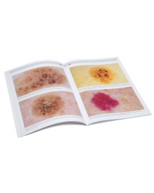HEINE compendio de dermatoscopia