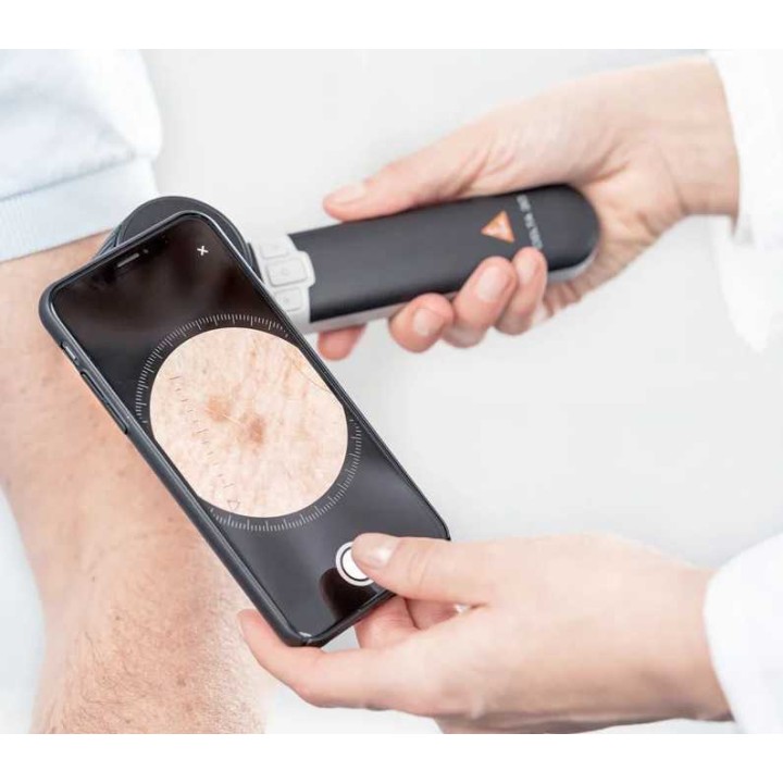 HEINE DELTA 30 Dermatoskop mit HEINE DERM App