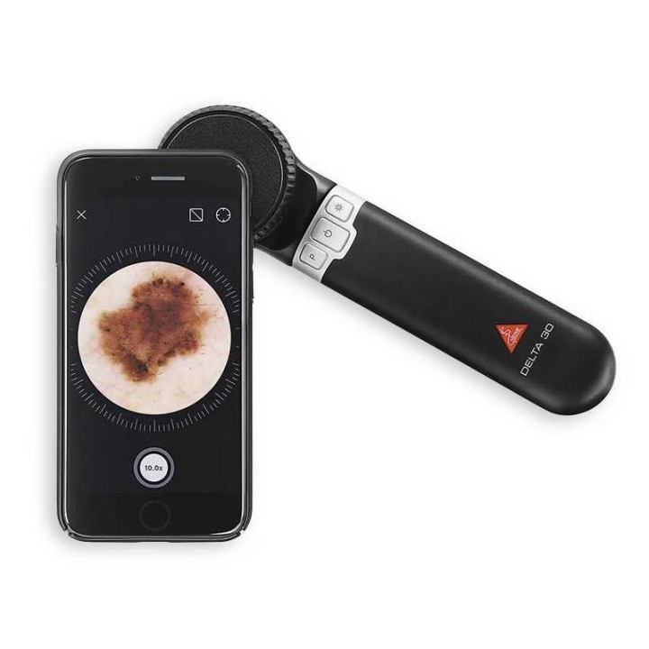 HEINE DELTA 30 Dermatoscope