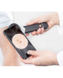 HEINE DELTA 30 Dermatoskop mit HEINE DERM App