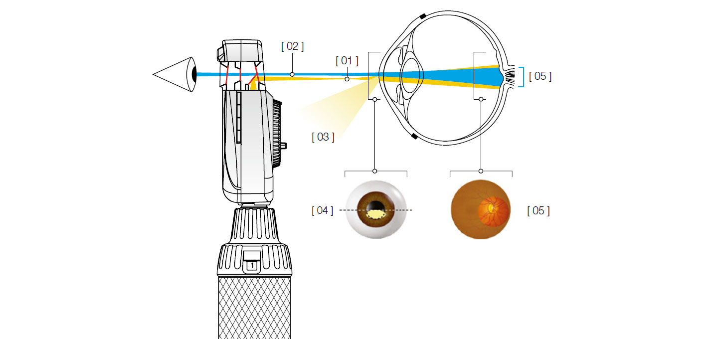 HEINE Aspherical Optical System (AOS)